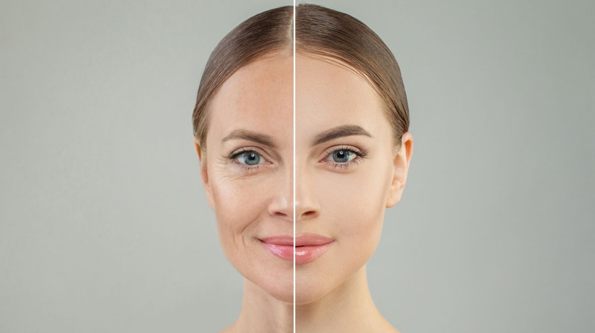 Anti ageing Treatment in Mumbai at mumbai cosmetic centre