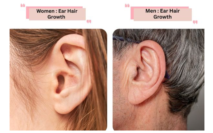 Ear lobe hair removal Treatment in Mumbai at Mumbai cosmetic centre